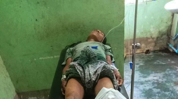 U Ko Chin, an ethnic Chin man in Minbya Township, was seriously injured in a landmine explosion on Monday. (Photo: APM)